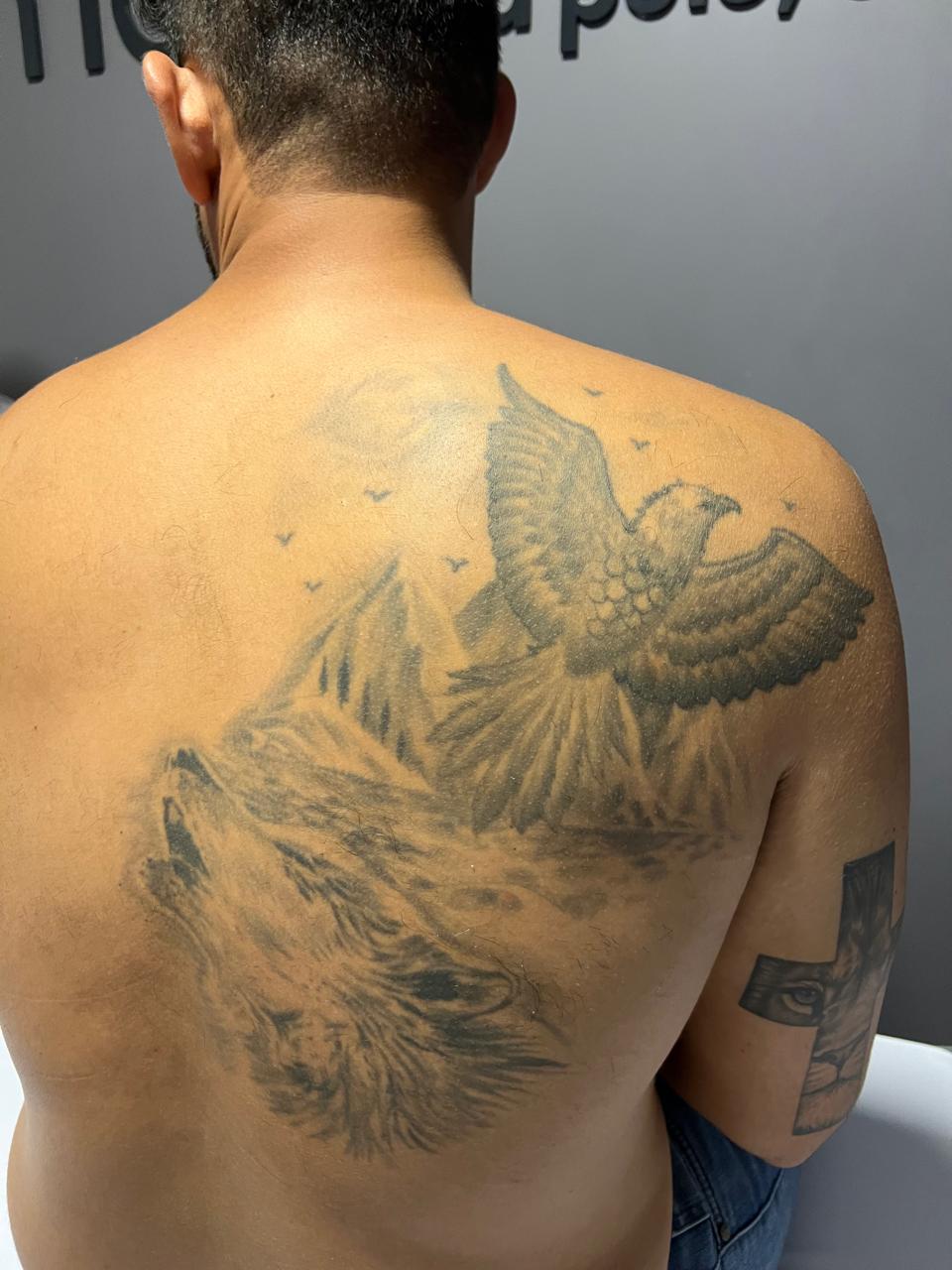 Antes do tratamento — caso 1