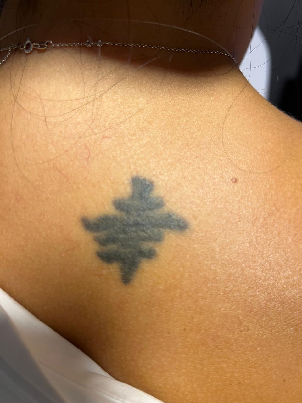 Antes do tratamento — caso 2