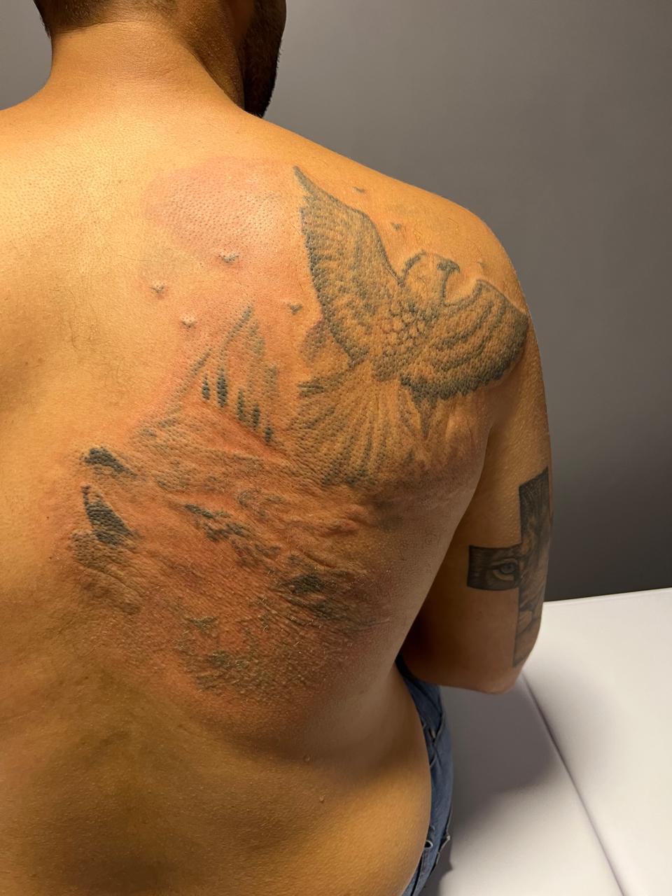 Depois do tratamento — caso 1